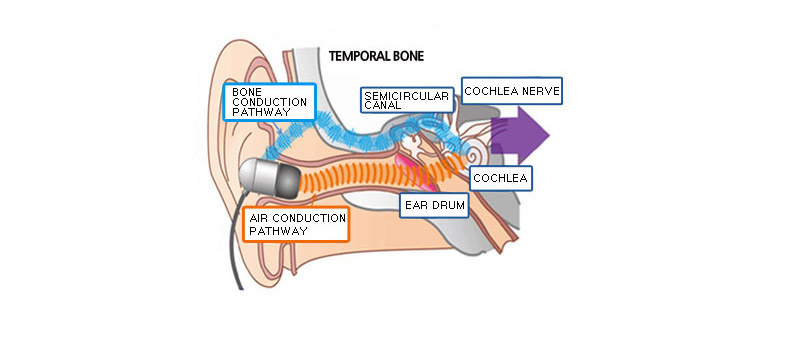 bone conduction sound
